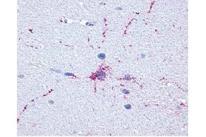 Brain, Neurons and Glia (GRM8 抗体  (C-Term))