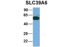 Western Blotting (WB) image for anti-Solute Carrier Family 39 (Zinc Transporter), Member 6 (SLC39A6) (Middle Region) antibody (ABIN2781630)