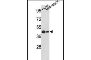 Western blot analysis of GSDMB Antibody (Center) (ABIN652499 and ABIN2842335) in HL-60, MDA-M cell line lysates (35 μg/lane). (Gasdermin B 抗体  (AA 208-237))