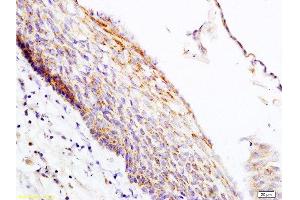 Immunohistochemistry (Paraffin-embedded Sections) (IHC (p)) image for anti-Period Circadian Protein 2 (PER2) (AA 751-850) antibody (ABIN751258)