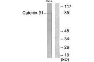 Western blot analysis of extracts from HeLa cells, using Catenin-beta1 Antibody. (CTNNB1 抗体  (AA 626-675))