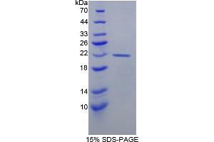 Image no. 1 for Casein beta (CSN2) (AA 41-198) protein (His tag) (ABIN6237247) (CSN2 Protein (AA 41-198) (His tag))