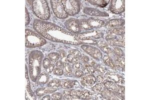 Immunohistochemical staining of human stomach with SH3TC1 polyclonal antibody  shows moderate cytoplasmic positivity in glandular cells. (SH3TC1 抗体)