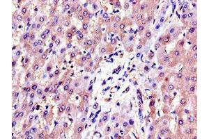 Immunohistochemistry of paraffin-embedded human liver tissue using ABIN7143701 at dilution of 1:100 (AKR1B1 抗体  (AA 114-230))