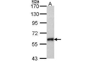 WB Image Sample (30 ug of whole cell lysate) A: Molt-4 , 7. (SOCS5 抗体  (N-Term))