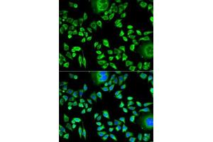 Immunofluorescence analysis of HeLa cells using CSTA antibody . (CSTA 抗体  (AA 1-98))