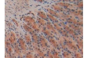 Detection of RSPO1 in Rat Stomach Tissue using Polyclonal Antibody to R-Spondin 1 (RSPO1)