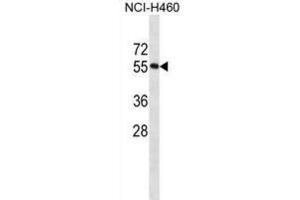 Western Blotting (WB) image for anti-RNA Binding Motif Protein 45 (RBM45) antibody (ABIN2998651) (RBM45 抗体)