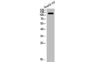 Western Blot analysis of HEPG2-UV cells using Acetyl-CRM1 (K568) Polyclonal Antibody (XPO1 抗体  (acLys568))