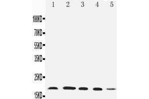 Anti-Diubiquitin antibody, Western blotting Lane 1: HELA Cell Lysate Lane 2: SKOV Cell Lysate Lane 3: MCF-7 Cell Lysate Lane 4: A549 Cell Lysate Lane 5: SMMC Cell Lysate (UBD 抗体  (N-Term))