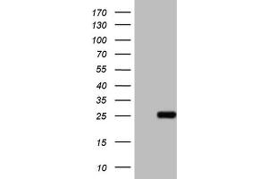 Western Blotting (WB) image for anti-ATP-Binding Cassette, Sub-Family C (CFTR/MRP), Member 5 (ABCC5) antibody (ABIN2715616) (ABCC5 抗体)