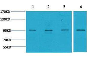 Western Blotting (WB) image for anti-Mitogen-Activated Protein Kinase 6 (MAPK6) antibody (ABIN3181516) (MAPK6 抗体)