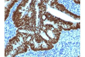 Immunohistochemistry (IHC) image for anti-Caudal Type Homeobox 2 (CDX2) (AA 150-249) antibody (ABIN6939057)