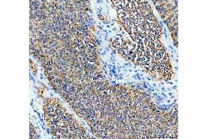 IHC analysis of SDHA using anti-SDHA antibody (ABIN3043324).