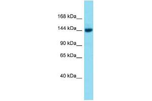 Host:  Rabbit  Target Name:  Brpf3  Sample Type:  Mouse Liver lysates  Antibody Dilution:  1. (BRPF3 抗体  (Middle Region))