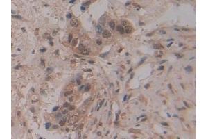 Immunohistochemistry (IHC) image for anti-Ribonuclease/angiogenin Inhibitor 1 (RNH1) (AA 218-444) antibody (ABIN7440089)