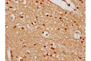 IHC image of ABIN7174162 diluted at 1:300 and staining in paraffin-embedded human brain tissue performed on a Leica BondTM system. (UTP18 抗体  (AA 13-152))