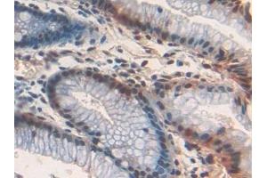 Immunohistochemistry (IHC) image for anti-Frizzled Family Receptor 1 (Fzd1) (AA 117-322) antibody (ABIN7435805)