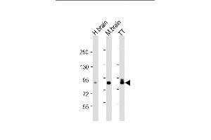 All lanes : Anti-DCLK1 Antibody at 1:4000 dilution Lane 1: human brain lysate Lane 2: mouse brain lysate Lane 3: TT whole cell lysate Lysates/proteins at 20 μg per lane. (DCLK1 抗体)