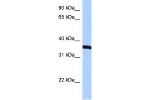 WB Suggested Anti-RPLP0 Antibody Titration:  0. (RPLP0 抗体  (N-Term))
