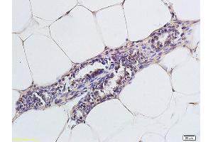 Formalin-fixed and paraffin embedded rat cells labeled with Anti-CCR4/CD194 Polyclonal Antibody, Unconjugated (ABIN738666) followed by conjugation to the secondary antibody and DAB staining (CCR4 抗体  (AA 201-300))