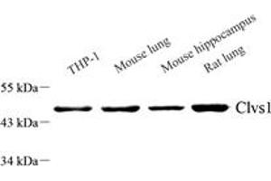Western blot analysis of Clavesin 1 (ABIN7073517) at dilution of 1: 1000,Lane 1: THP-1 cell lysate,Lane 2: Mouse lung tissue lysate,Lane 3: Mouse hippocampus tissue lysate,Lane 4: Rat lung tissue lysate (Clavesin 1 抗体)