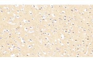 Detection of CASP3 in Human Cerebrum Tissue using Polyclonal Antibody to Caspase 3 (CASP3)