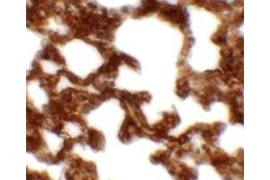 Immunohistochemistry (IHC) image for anti-Neuropilin (NRP) and Tolloid (TLL)-Like 1 (NETO1) (C-Term) antibody (ABIN1030539) (NETO1 抗体  (C-Term))