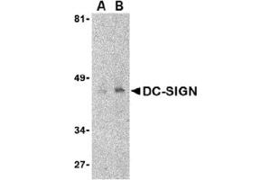 Western Blotting (WB) image for anti-CD209 (CD209) (Extracellular Domain) antibody (ABIN492511) (DC-SIGN/CD209 抗体  (Extracellular Domain))