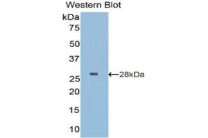 Western Blotting (WB) image for anti-Insulin-Like Growth Factor Binding Protein 5 (IGFBP5) (AA 27-248) antibody (ABIN5662063) (IGFBP5 抗体  (AA 27-248))