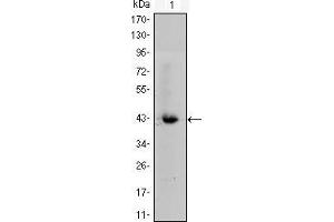 Western blot analysis using CTNNB1 mouse mAb against CTNNB1-hIgGFc transfected HEK293 cell lysate. (CTNNB1 抗体)