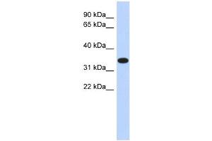 ACTRT1 antibody used at 1 ug/ml to detect target protein. (ACTRT1 抗体  (Middle Region))