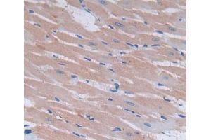 Used in DAB staining on fromalin fixed paraffin- embedded heart tissue (Endothelin 3 抗体  (AA 20-167))