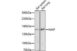 Western blot analysis of extracts of various cell lines using NAIP Polyclonal Antibody at dilution of 1:1000. (NAIP 抗体)