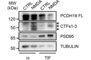 Western blot of total homogenate (H) and TIF fraction from rat hippocampal neurons treated with vehicle (CTRL) or NMDA.