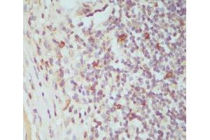 Immunohistochemistry of paraffin-embedded Human tonsil using CTLA4 Polyclonal Antibody at dilution of 1:100 (40x lens). (CTLA4 抗体)