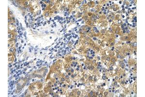 Rabbit Anti-CD36 Antibody       Paraffin Embedded Tissue:  Human hepatocyte   Cellular Data:  Epithelial cells of renal tubule  Antibody Concentration:   4. (CD36 抗体  (N-Term))