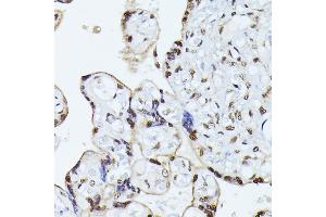 Immunohistochemistry of paraffin-embedded human placenta using HNRNPL antibody (ABIN6128048, ABIN6141915, ABIN6141917 and ABIN6216076) at dilution of 1:100 (40x lens). (HNRNPL 抗体  (AA 282-589))