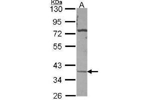 WB Image Sample (30 ug of whole cell lysate) A: A431 , 10% SDS PAGE antibody diluted at 1:500 (CA11 抗体)