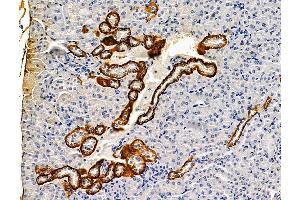 ABIN7096237 and ABIN7100299 at 1/100 staining mouse kidney tissue by IHC-P. (CXORF23 抗体)