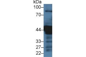 Western blot analysis of Human HeLa (3u) cell lysate, using Pig KRT18 Antibody (3 µg/ml) and HRP-conjugated Goat Anti-Rabbit antibody ( (Cytokeratin 18 抗体  (AA 1-159))