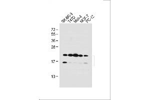 All lanes : Anti-UBE2W Antibody (C-term) at 1:1000 dilution Lane 1: SK-BR-3 whole cell lysate Lane 2: T47D whole cell lysate Lane 3: Molt-4 whole cell lysate Lane 4: MCF-7 whole cell lysate Lane 5: PC-12 whole cell lysate Lysates/proteins at 20 μg per lane.