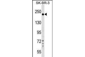 SHROOM2 Antibody (Center) (ABIN1538525 and ABIN2849363) western blot analysis in SK-BR-3 cell line lysates (35 μg/lane). (SHROOM2 抗体  (AA 599-625))