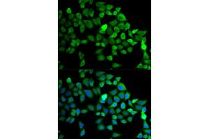 Immunofluorescence analysis of MCF-7 cells using CUL2 antibody (ABIN5975808). (Cullin 2 抗体)