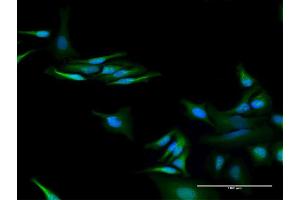Immunofluorescence of purified MaxPab antibody to C13orf18 on HeLa cell. (C13orf18 抗体  (AA 1-595))