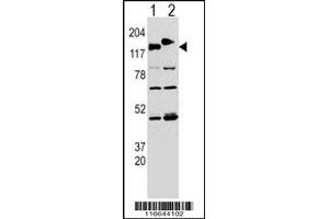 Western blot analysis of CLASP using rabbit polyclonal CLASP Antibody (Y1019) using 293 cell lysates transfected with the ACADL gene (Lane 1) and with the GFP-CLASP (Lane 2). (CLASP2 抗体  (AA 998-1026))