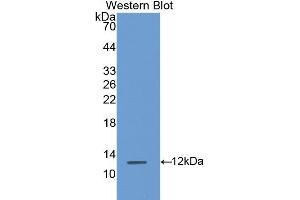 Detection of Recombinant S100A8, Rat using Polyclonal Antibody to S100 Calcium Binding Protein A8 (S100A8) (S100A8 抗体  (AA 1-89))
