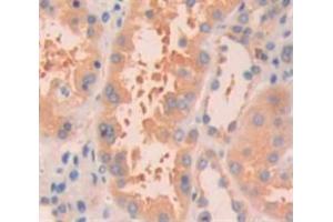Immunohistochemistry (IHC) image for anti-Regulator of Chromosome Condensation (RCC1) and BTB (POZ) Domain Containing Protein 2 (RCBTB2) (AA 394-519) antibody (ABIN1870265)