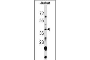 Western Blotting (WB) image for anti-Small Nuclear RNA Activating Complex, Polypeptide 1, 43kDa (SNAPC1) (AA 139-168) antibody (ABIN5537362)
