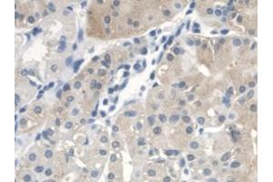 Detection of CTBS in Human Stomach Tissue using Polyclonal Antibody to Di-N-Acetyl Chitobiase (CTBS) (CTBS 抗体  (AA 47-385))